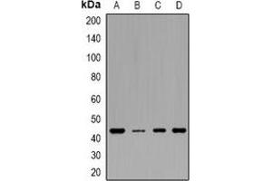 Western blot analysis of IDH3 gamma expression in HEK293T (A), MCF7 (B), mouse heart (C), rat heart (D) whole cell lysates. (IDH3G 抗体)