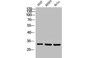Western Blot analysis of 293T HELA using Carbonyl Reductase 1 Polyclonal Antibody. (CBR1 抗体  (Internal Region))