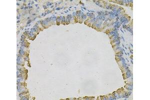 Immunohistochemistry of paraffin-embedded Mouse lung using AZGP1 Polyclonal Antibody at dilution of 1:100 (40x lens). (AZGP1 抗体)