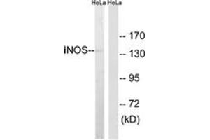 Western blot analysis of extracts from HeLa cells, using iNOS Antibody.