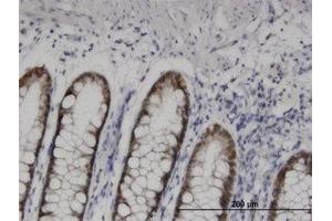 Image no. 1 for anti-Homeobox D11 (HOXD11) (AA 1-77) antibody (ABIN599383) (HOXD11 抗体  (AA 1-77))