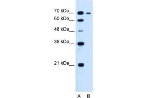 Western Blotting (WB) image for anti-Ribonucleotide Reductase M1 (RRM1) antibody (ABIN2462920) (RRM1 抗体)