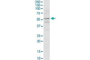 ACADM MaxPab rabbit polyclonal antibody. (Medium-Chain Specific Acyl-CoA Dehydrogenase, Mitochondrial (MCAD) (AA 1-421) 抗体)