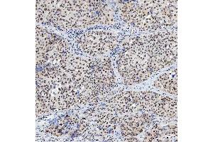 IHC analysis of SNRNP200 using anti-SNRNP200 antibody (ABIN7602032). (SNRNP200 抗体  (AA 557-2129))