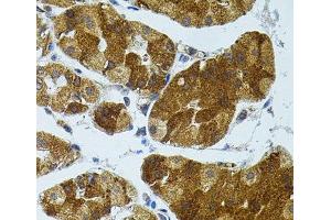 Immunohistochemistry of paraffin-embedded Human stomach using CETP Polyclonal Antibody (CETP 抗体)