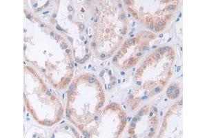 Used in DAB staining on fromalin fixed paraffin- embedded kidney tissue (Secernin 1 抗体  (AA 2-414))