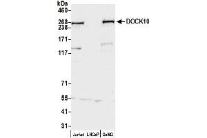 anti-Dedicator of Cytokinesis 10 (DOCK10) (AA 100-150) antibody