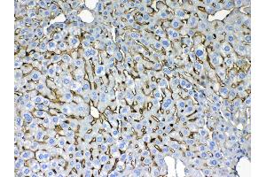 IHC analysis of Cytokeratin 8 using anti- Cytokeratin 8 antibody .