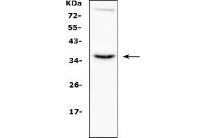 Western blot analysis of CD40L using anti-CD40L antibody (ABIN5692813). (CD40 Ligand 抗体  (AA 107-260))