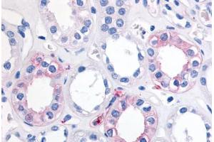 Human Kidney (formalin-fixed, paraffin-embedded) stained with EPHX2 antibody ABIN290080 at 20 ug/ml followed by biotinylated goat anti-rabbit IgG secondary antibody ABIN481713, alkaline phosphatase-streptavidin and chromogen. (EPHX2 抗体  (Internal Region))