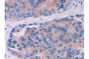 Immunohistochemistry (IHC) image for anti-Interleukin 10 Receptor, alpha (IL10RA) (AA 132-235) antibody (ABIN7433870)