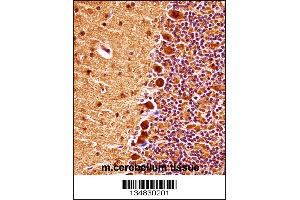 Immunohistochemistry (IHC) image for anti-Mitogen-Activated Protein Kinase 9 (MAPK9) (AA 206-233) antibody (ABIN5533806)