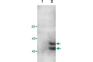 Western blot analysis of human fetal muscle lysate with PARP11 polyclonal antibody  at 1 : 200 dilution. (PARP11 抗体  (C-Term))