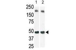 The anti-SphK1 Pab is used in Western blot (Lane 2) to detect c-myc-tagged SphK1 in transfected 293 cell lysate (a c-myc antibody is used as control in Lane 1). (SPHK1 抗体  (N-Term))