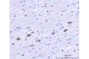 IHC analysis of Adgrg1 using anti-Adgrg1 antibody (ABIN7601979). (Adhesion G Protein-Coupled Receptor G1 (ADGRG1) (AA 53-554) 抗体)