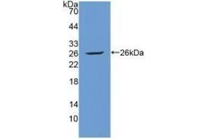 Detection of Recombinant Tie1, Human using Polyclonal Antibody to Tyrosine Kinase With Immunoglobulin Like And EGF Like Domains Protein 1 (Tie1) (TIE1 抗体  (AA 701-898))