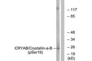 Western blot analysis of extracts from HepG2 cells treated with nocodazole 1ug/ml 16h, using CRYAB (Phospho-Ser19) Antibody. (CRYAB 抗体  (pSer19))