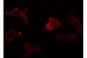 ABIN6275370 staining  Hela cells by IF/ICC. (KCNK1 抗体  (N-Term))