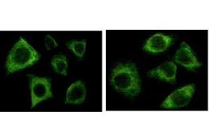 Immunofluorescence staining of methanol-fixed Eca-109 (left) and HepG2 (right) cells showing cytoplasmic localization. (pan Keratin 抗体)