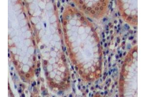 Immunohistochemistry (IHC) image for anti-Carbonic Anhydrase IX (CA9) (AA 59-414) antibody (ABIN7437167)