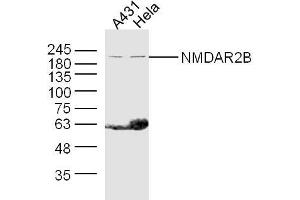 Western Blotting (WB) image for anti-Glutamate Receptor, Ionotropic, N-Methyl D-Aspartate 2B (GRIN2B) (AA 451-550) antibody (ABIN726485)