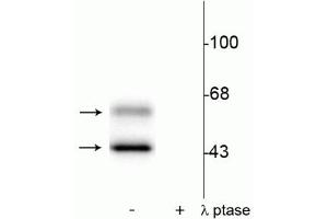 Western blot of rat brain lysate showing specific immunolabeling of the ~50 kDa α- and the ~60 kDa β-CaM Kinase II phosphorylated at Thr286 in the first lane (-). (CaMKII alpha/beta (pThr286) 抗体)