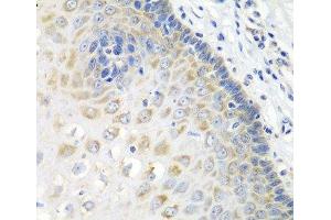 Immunohistochemistry of paraffin-embedded Human esophagus using STXBP4 Polyclonal Antibody at dilution of 1:100 (40x lens). (STXBP4 抗体)
