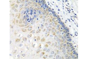 Immunohistochemistry of paraffin-embedded Human esophagus using STXBP4 Polyclonal Antibody at dilution of 1:100 (40x lens). (STXBP4 抗体)