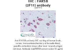 Image no. 3 for anti-Phenylalanyl-tRNA Synthetase, beta Subunit (FARSB) (AA 234-342) antibody (ABIN1723557) (FARSB 抗体  (AA 234-342))
