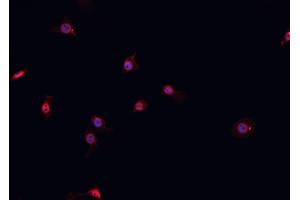 ABIN6267056 staining A-431 cells by IF/ICC. (Cyclin D1 抗体  (C-Term))
