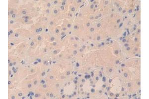 IHC-P analysis of Human Kidney Tissue, with DAB staining. (TPSD1 抗体  (AA 99-191))