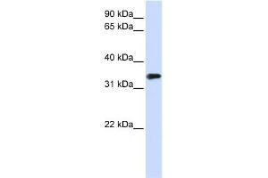 WB Suggested Anti-MBD3 Antibody Titration:  0. (MBD3 抗体  (N-Term))