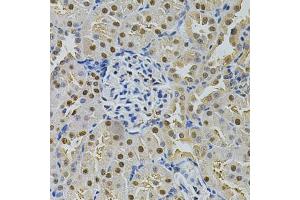 Immunohistochemistry of paraffin-embedded rat kidney using SQSTM1 Antibody. (SQSTM1 抗体)