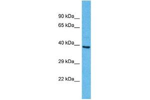 Western Blotting (WB) image for anti-Olfactory Receptor, Family 2, Subfamily A, Member 25 (OR2A25) (C-Term) antibody (ABIN2791720) (OR2A25 抗体  (C-Term))