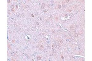Immunohistochemical staining of rat brain tissue with DCLK1 polyclonal antibody  at 25 ug/mL dilution. (DCLK1 抗体  (N-Term))