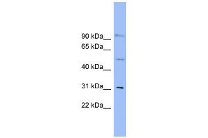 WB Suggested Anti-SLC25A25 Antibody Titration:  0. (SLC25A25 抗体  (N-Term))