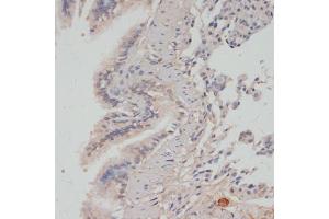 Immunohistochemistry (IHC) image for anti-Protein Phosphatase 1, Catalytic Subunit, alpha Isoform (PPP1CA) (pThr320) antibody (ABIN7269674)