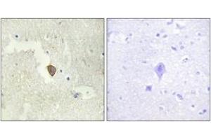 Immunohistochemistry analysis of paraffin-embedded human brain tissue, using ADCY7 Antibody. (ADCY7 抗体  (AA 191-240))