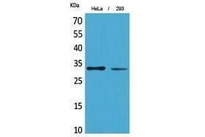 Western Blotting (WB) image for anti-Succinate Dehydrogenase Complex, Subunit B, Iron Sulfur (Ip) (SDHB) (Internal Region) antibody (ABIN3187945) (SDHB 抗体  (Internal Region))