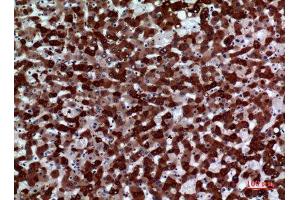 Immunohistochemistry (IHC) analysis of paraffin-embedded Human Liver, antibody was diluted at 1:100. (FMO3 抗体  (Internal Region))