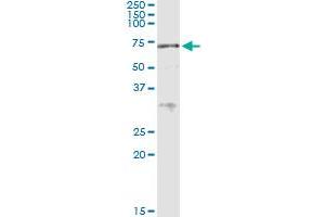 Immunoprecipitation of ACD transfected lysate using anti-ACD MaxPab rabbit polyclonal antibody and Protein A Magnetic Bead , and immunoblotted with ACD purified MaxPab mouse polyclonal antibody (B01P) . (ACD 抗体  (AA 1-544))