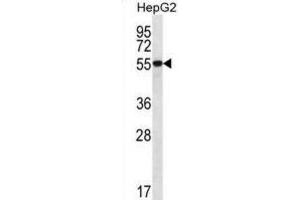 Western Blotting (WB) image for anti-UDP-Glucose 6-Dehydrogenase (UGDH) antibody (ABIN2996851) (UGDH 抗体)