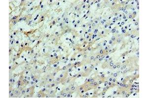Immunohistochemistry (IHC) image for anti-Cleavage Stimulation Factor, 3' Pre-RNA, Subunit 2, 64kDa (CSTF2) (AA 1-180) antibody (ABIN7147929)