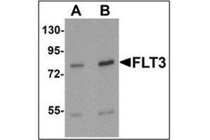 Western blot analysis of FLT3 in 3T3 cell lysate with FLT3 antibody at (A) 1 and (B)2 ug/mL. (FLT3 抗体  (N-Term))