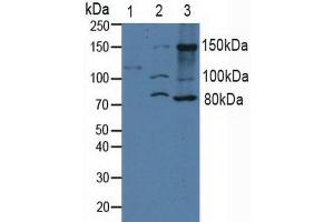 Western blot analysis of (1) Human Serum, (2) Human 293T Cells and (3) Human A431 Cells.