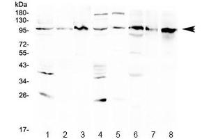 Western blot testing of 1) rat brain, 2) rat kidney, 3) rat NRK, 4) mouse brain, 5) mouse kidney, 6) human HeLa, 7) human Jurkat and 8) human K562 lysate with AGO1 antibody at 0. (AGO1 抗体  (AA 376-409))
