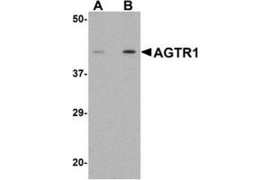Western blot analysis of AGTR1 in mouse kidney tissue lysate with AGTR1 antibody at (A) 1 and (B) 2 μg/ml. (Angiotensin II Type-1 Receptor 抗体  (Center))