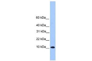 TRAPPC6B antibody used at 1 ug/ml to detect target protein. (TRAPPC6B 抗体  (Middle Region))