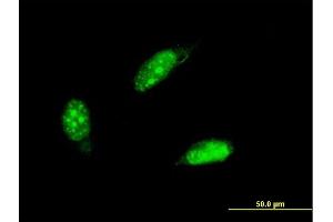 Immunofluorescence of monoclonal antibody to PCNA on HeLa cell. (PCNA 抗体  (AA 152-261))