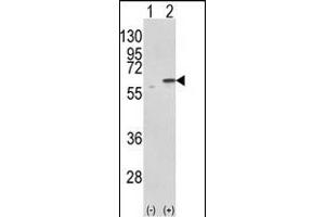 Western blot analysis of PDIA3 (arrow) using rabbit polyclonal PDIA3 Antibody (C-term) (ABIN389464 and ABIN2839529). (PDIA3 抗体  (C-Term))